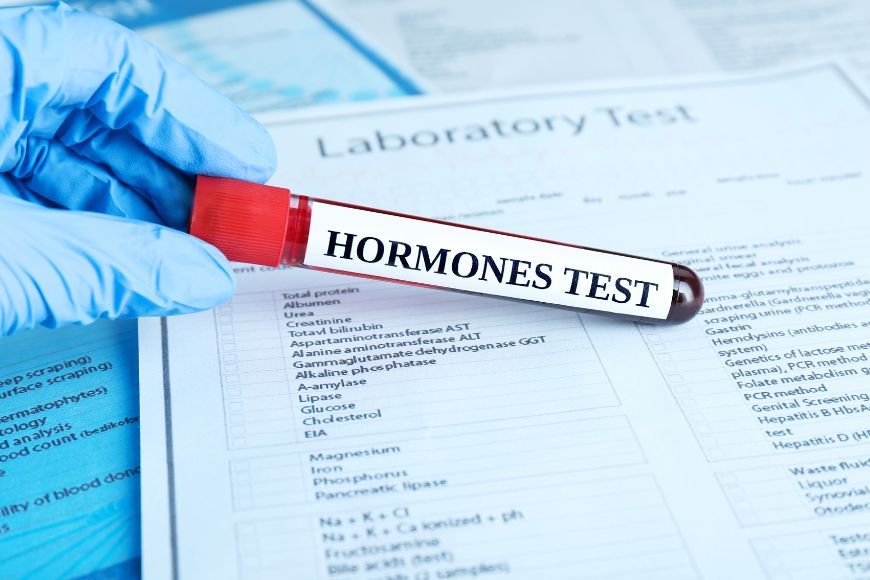 Female Hormone Health Check
